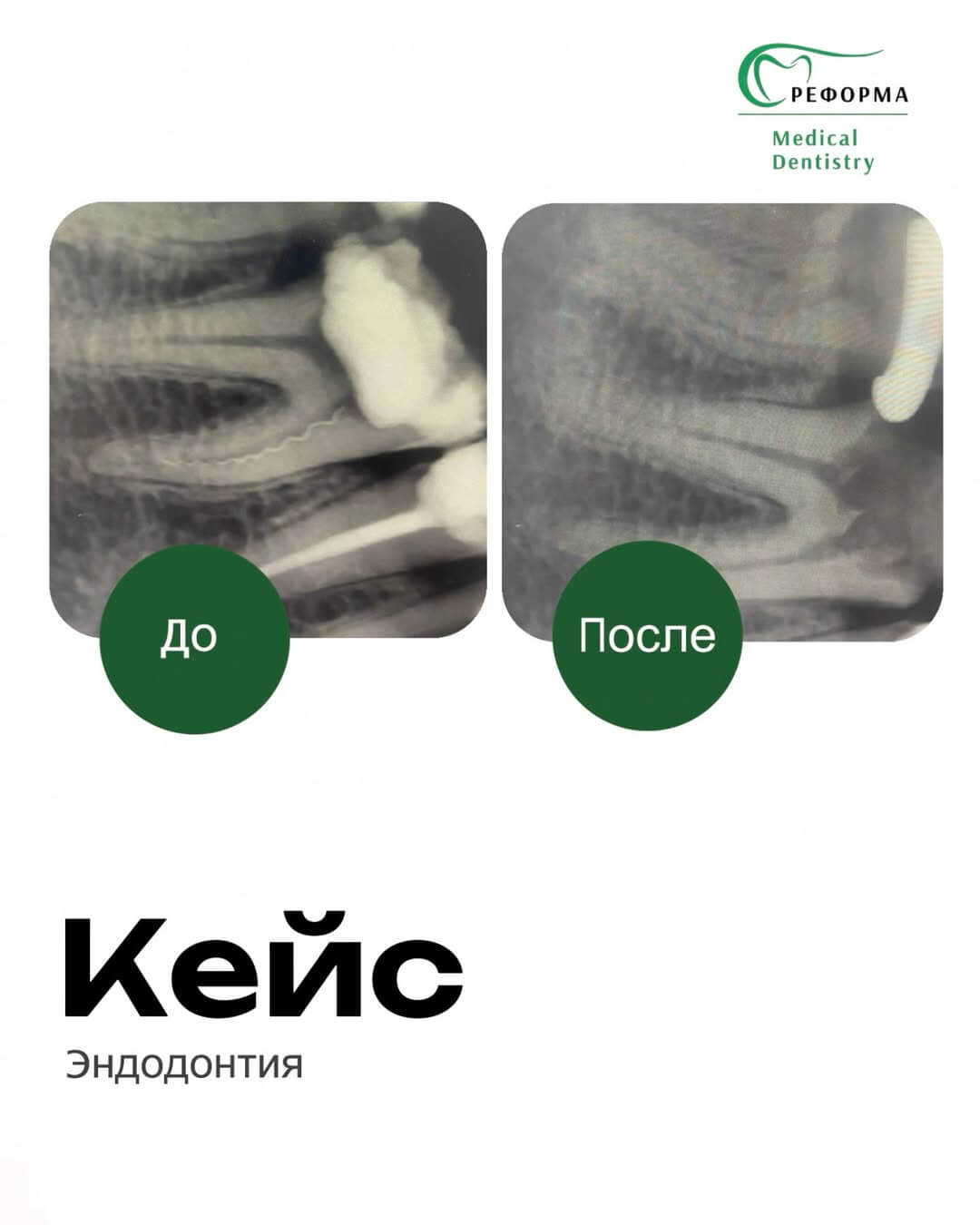 Кейс от страха к радости